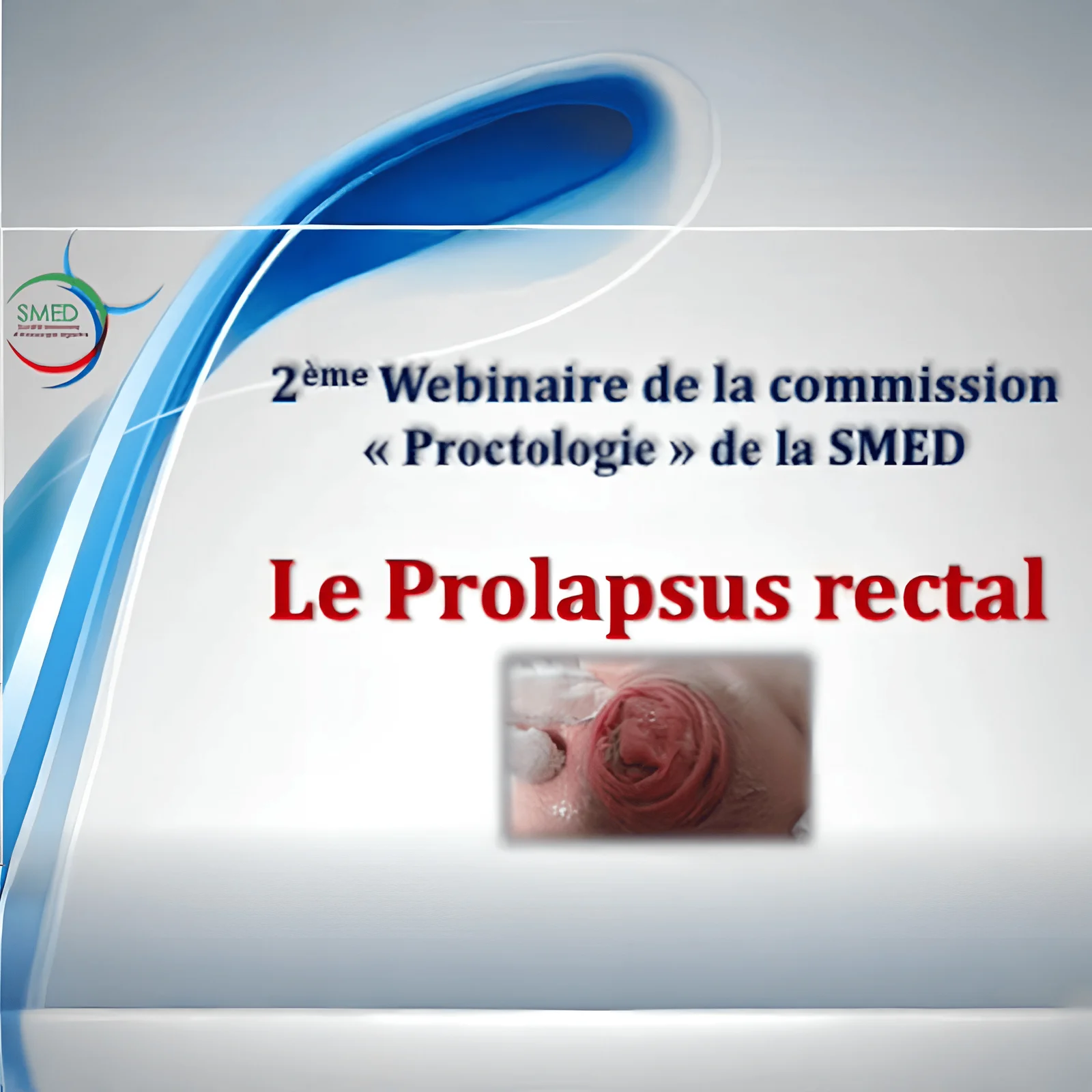 Webinaire de la Commission Proctologie - Prolapsus rectal - Dr François Pigot -  30 Janvier 2025